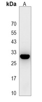 Anti-YAE1D1 Antibody