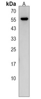 Anti-NETO2 Antibody