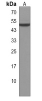 Anti-NLE1 Antibody