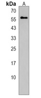 Anti-ERO1L Antibody