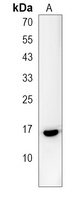 Anti-PRR15L Antibody
