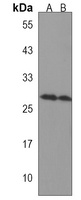 Anti-CCDC134 Antibody