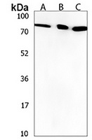 Anti-ZNF555 Antibody