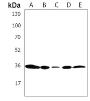 Anti-SSX4 Antibody