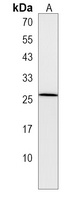 Anti-LHFPL1 Antibody