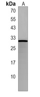 Anti-MRAP2 Antibody