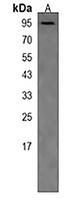 Anti-PAPOLG Antibody