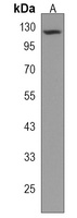 Anti-UNC5D Antibody