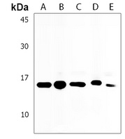 Anti-HIST1H2AB Antibody
