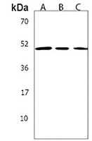 Anti-KREMEN2 Antibody