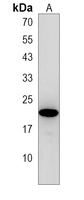 Anti-CSHL1 Antibody