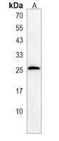 Anti-CCDC90B Antibody