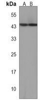 Anti-DUX4 Antibody