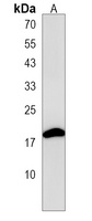 Anti-STMN3 Antibody