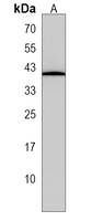 Anti-SP6 Antibody