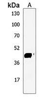 Anti-GAL3ST4 Antibody