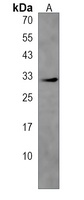 Anti-C2orf73 Antibody