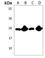 Anti-RAB11B Antibody