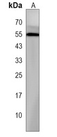 Anti-TP-1 Antibody