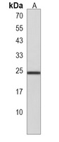 Anti-RPL15 Antibody