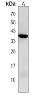 Anti-SPOPL Antibody