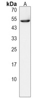 Anti-CLEC18A Antibody