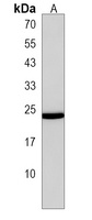 Anti-TM4SF1 Antibody