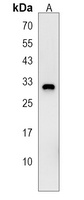 Anti-KRT222 Antibody