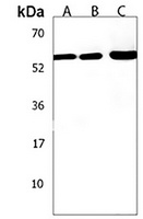 Anti-ZNF562 Antibody