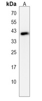 Anti-Serpin E2 Antibody