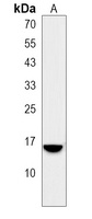 Anti-SPINK8 Antibody