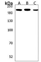 Anti-PREX1 Antibody