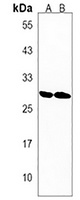 Anti-DHRS4L1 Antibody