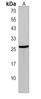 Anti-WFDC1 Antibody