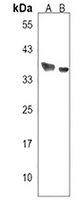 Anti-PPP1R42 Antibody