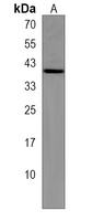 Anti-CHMP6 Antibody