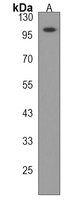 Anti-ESPNL Antibody