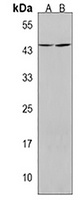 Anti-CCDC109B Antibody