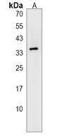 Anti-OR51Q1 Antibody
