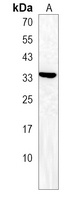 Anti-SFTPA2 Antibody