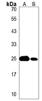 Anti-SDHD Antibody