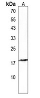 Anti-MBD3L3 Antibody