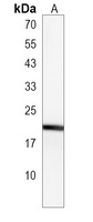 Anti-RBPMS2 Antibody