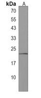 Anti-IL-17B Antibody