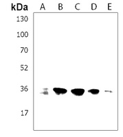 Anti-PPP1R3G Antibody