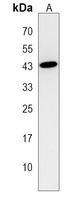 Anti-MOGAT3 Antibody