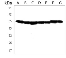 Anti-TUBB2B Antibody