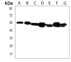 Anti-TUBB6 Antibody