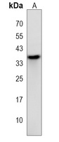Anti-OR2AT4 Antibody
