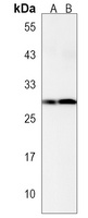 Anti-PABPN1L Antibody